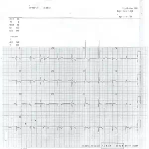 2001 Dextrocardia